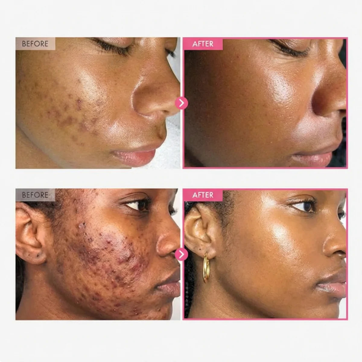 Skincare