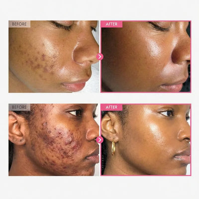 Skincare
